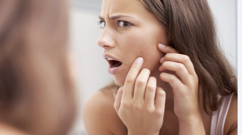 Can Cellphones Cause Acne and Skin Diseases?